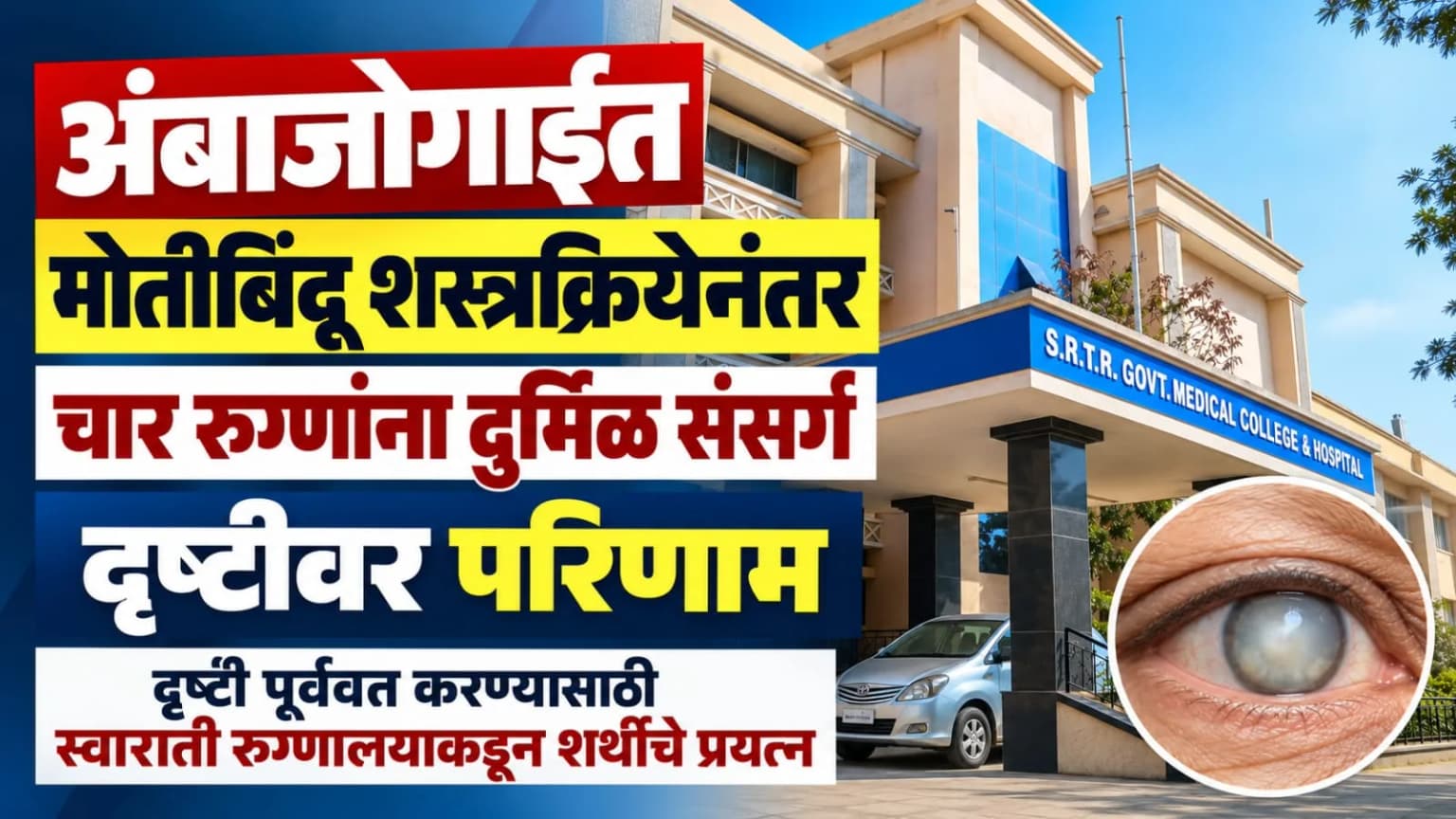 अंबाजोगाईत मोतीबिंदू शस्त्रक्रियेनंतर चार रुग्णांना दुर्मिळ संसर्ग, दृष्टीवर परिणाम; दृष्टी पूर्ववत करण्यासाठी स्वाराती रुग्णालयाकडून शर्थीचे प्रयत्न