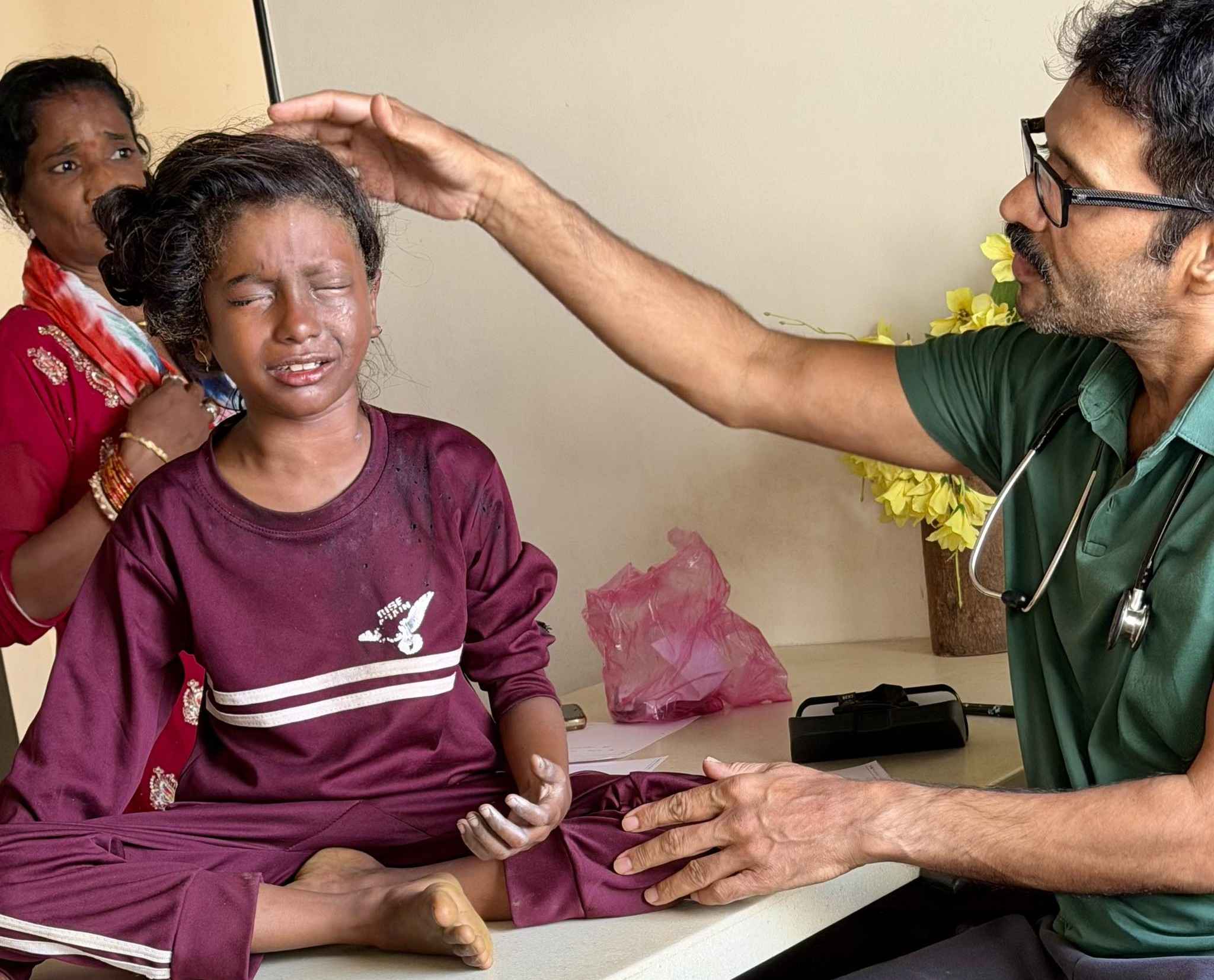 फटाक्यांतील बारूद काढून पेटवल्याने आठ वर्षीय बालक गंभीर भाजला; दृष्टी गमावण्याची शक्यता